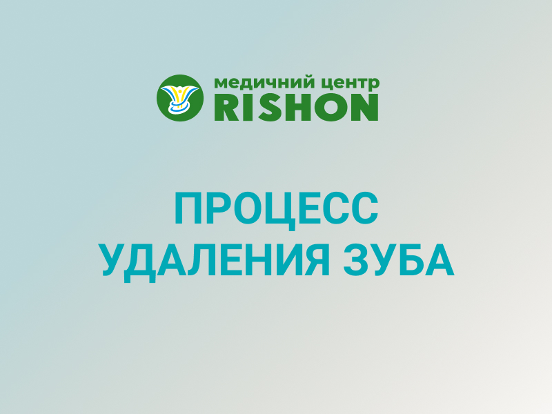 удаление зуба стоматология харьков