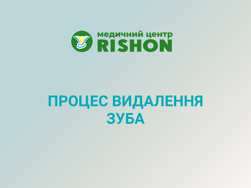 видалення зуба стоматологія харків