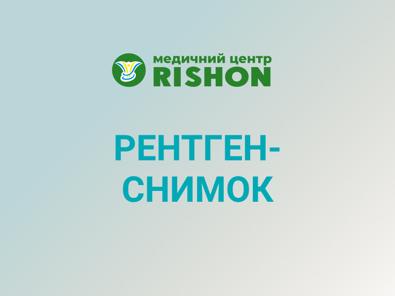 рентген полости рта клиника ришон