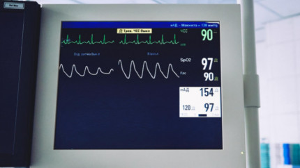 Что такое электрокардиография (ЭКГ)
