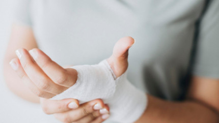 Хронические раны и их признаки