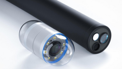 Почему не следует откладывать эндоскопию?