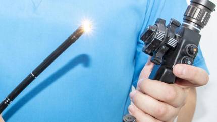 Я влип, у мене поліп