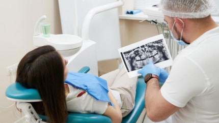Рентген полости рта
