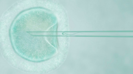 Какие риски для организма женщины приносит ЭКО Какие риски для организма женщины приносит ЭКО